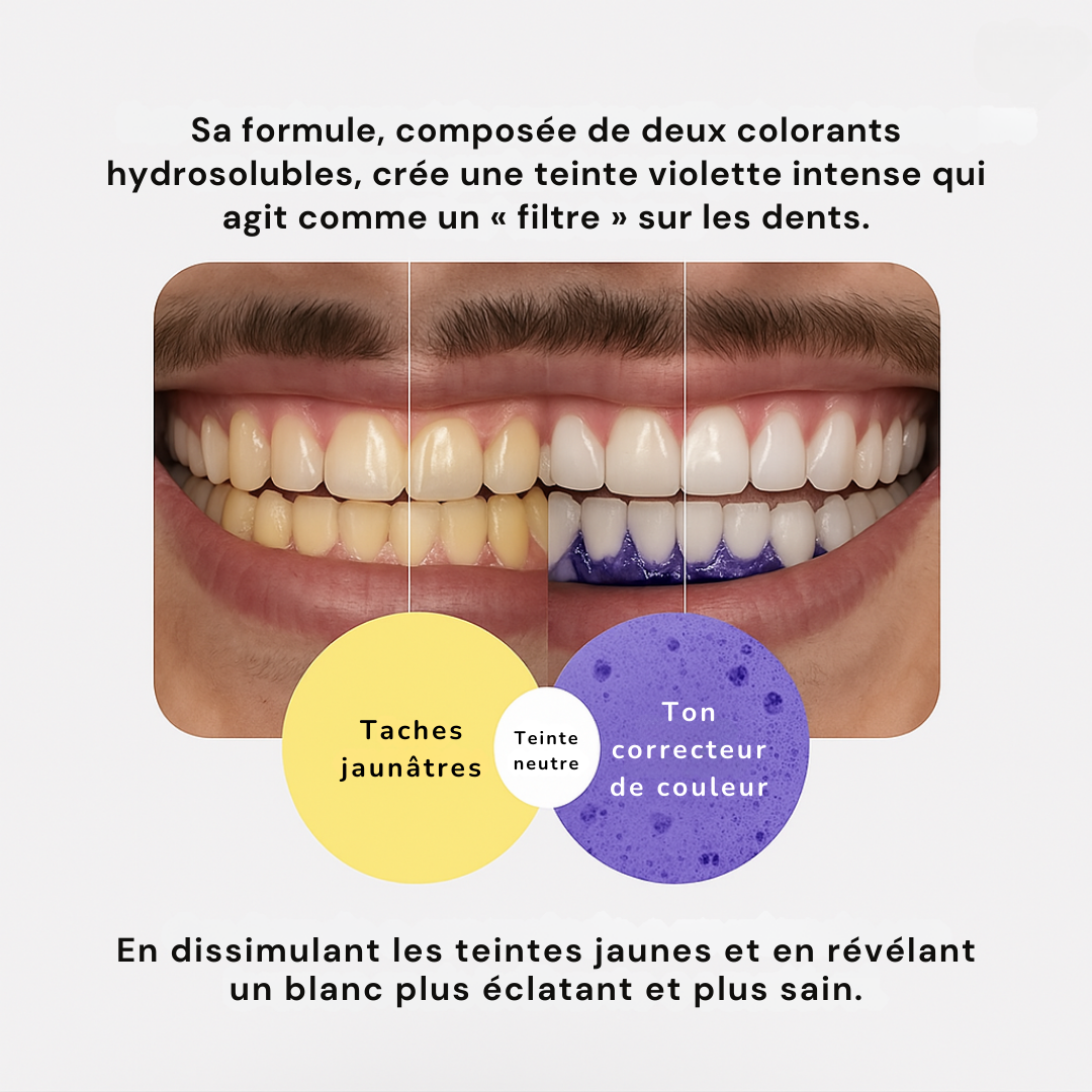 Blanchisseur Dentaire - V34™ Serum