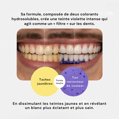 Blanchisseur Dentaire - V34™ Serum